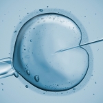 Acupunctuur en IVF, KI en IUI